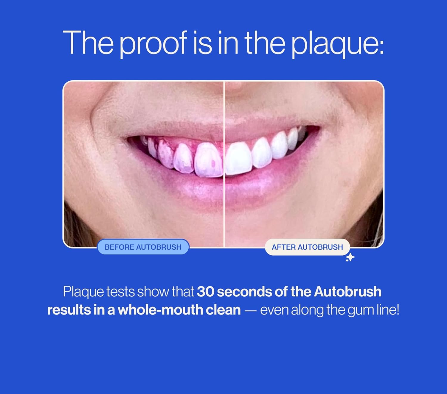 Pro Sonic Kids Oral Care Bundle